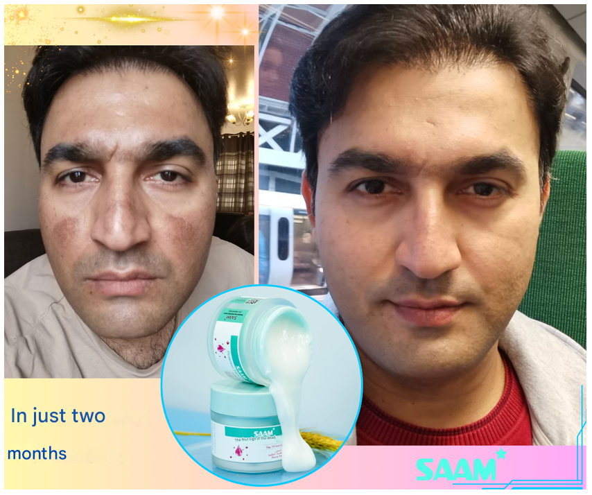 SAAM Renewal Youthful Glow Skin Solution